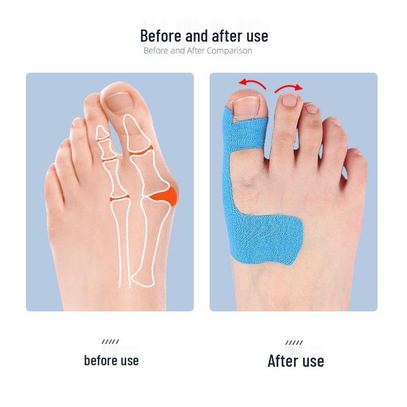 Big Toe Hallux Valgus Correction Adhesive Muscle Tape Bandage