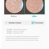 Meditherapy - Porethera Shot Exosome Spicule Serum & Minimizer Set