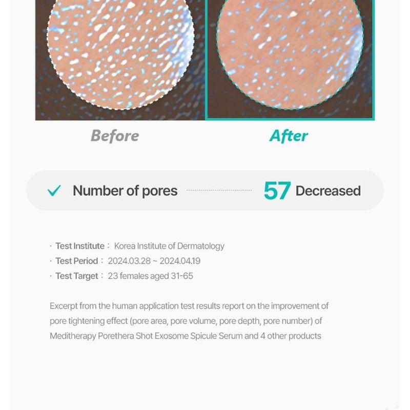Meditherapy - Porethera Shot Exosome Spicule Serum & Minimizer Set