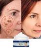 Bělicí krém na pihy, odstraňující melasma, krém na odstranění tmavých skvrn, proti vráskám, rozjasňující hydratační péče o pleť pro unisex