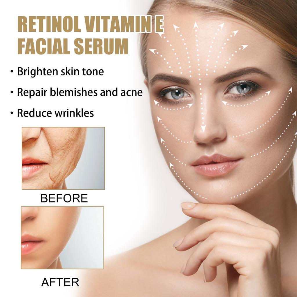 Eelhoe Retinol Vitamin E Night Facial Serum For Radiant Skin Hydrating Brightening Essence