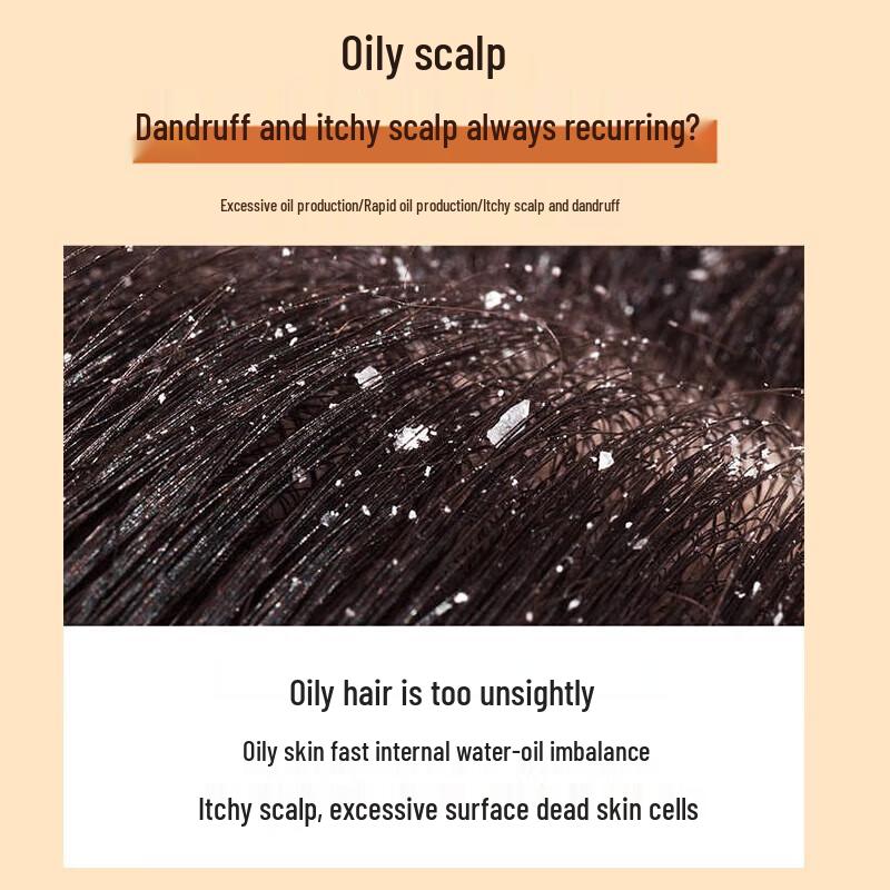 Ziyuan Anti-Dandruff & Oil Control Shampoo