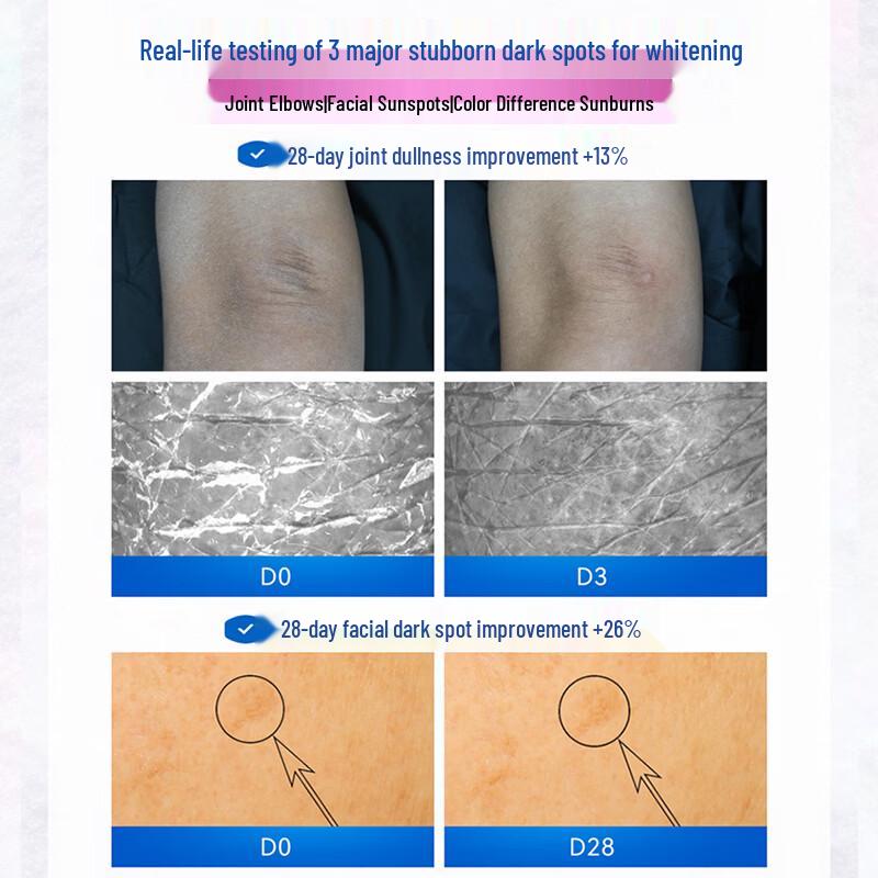 Vaseline Crema Schiarente Corpo e Viso Biancaneve