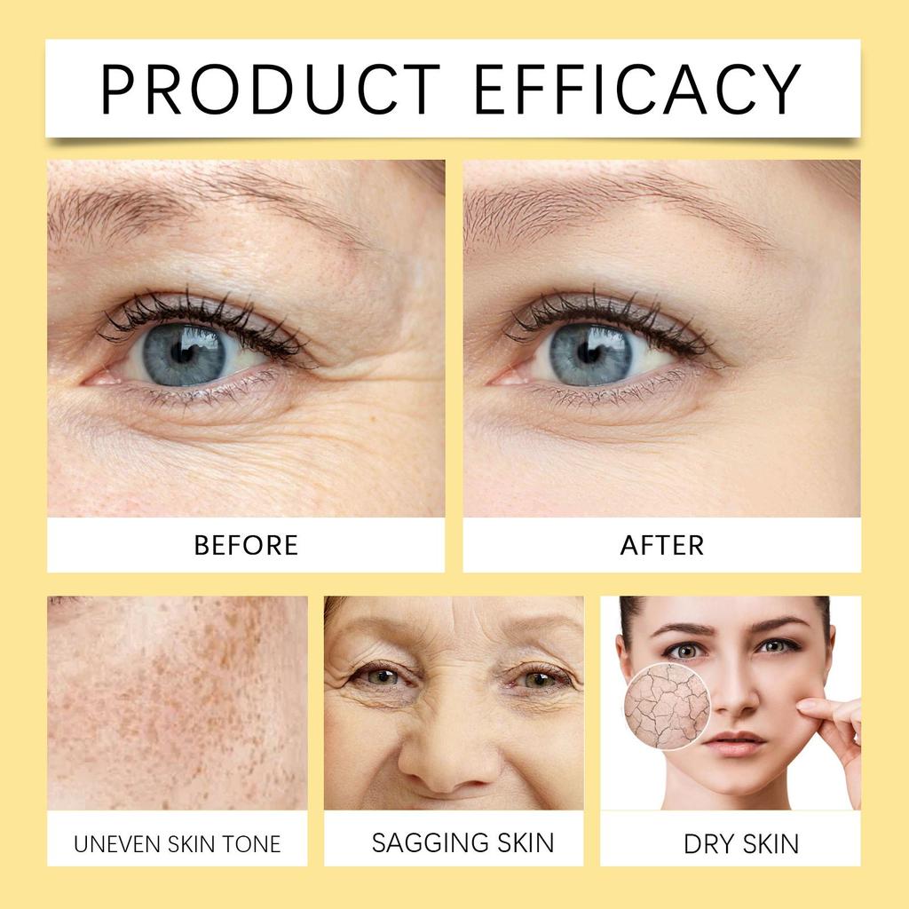 Bee Venom Skin Cream Gentle Nourishing Care Facial Skin Moisturizing Hydrating Softening Skin Cream