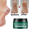 Effective Odor Treatment Nourishing Anti Cracking Cream Skin Care Products Dead Skin Remover Chapped Repair Cream