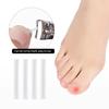 50Pcs Elastic Patch Sticker Pedicure Tool Ingrown Toenail Correction Tool Ingrown Toe Nail Treatment Straightening Clip Brace