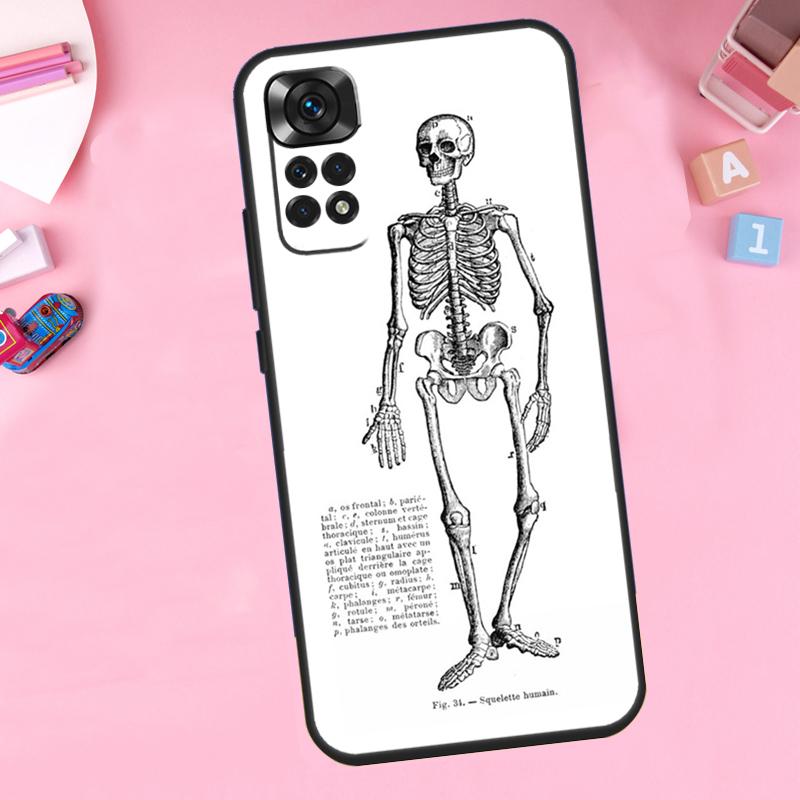Skeleton Art For Xiaomi Redmi Note 14 10 11 12 13 15 Pro Plus Phone Case For Redmi 15 15C 14C 12C 10C 13C