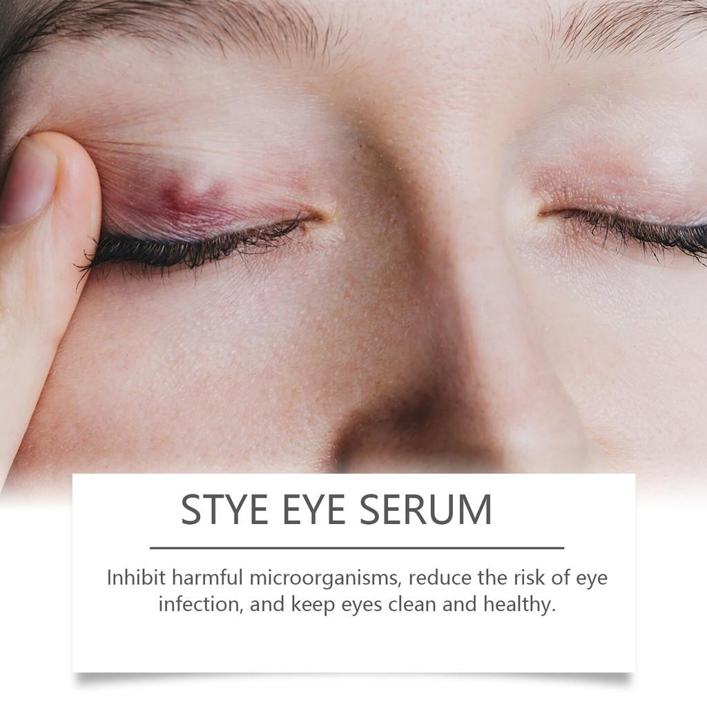 Ouhoe Gentle Moisturizing Eye Care Liquid For Soothing Relief And Daily Hydration 30ml