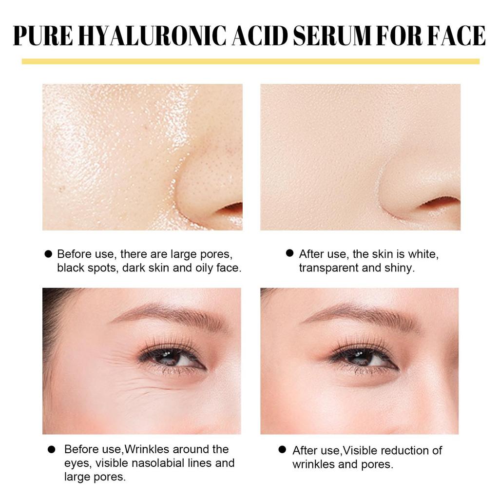 EELHOE Protein Line Firming & Lifting Kit Face Fine Lines Contouring Skin Firming Moisturizing Serum