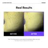 FRANKLY - Closer Pore Minimizing Mask Pack