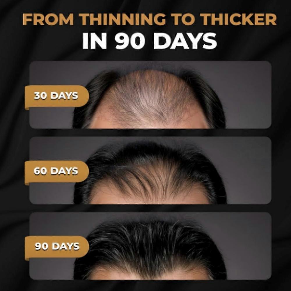 1-3x SPARTAN Haarwurzel-Aktivator Shampoo für Männer - Haarwachstumsshampoo gegen Haarausfall und dünner werdendes Haar