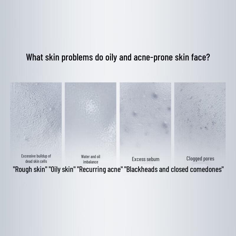 PROYA Revitalizing Multi-Acid Mask 2.0