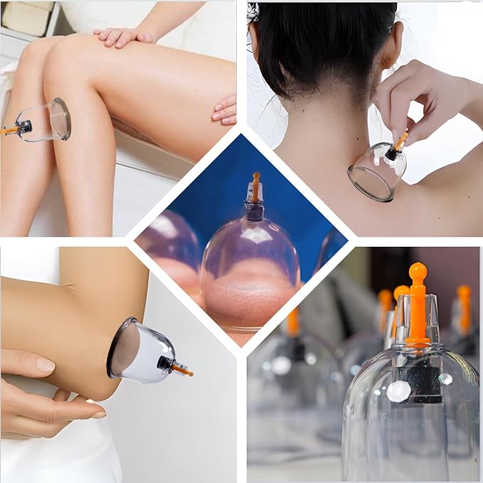 Koppesett, Koppingterapisett, 12/18/24 kopper Profesjonelt kinesisk koppesett for massasje rygg, smertelindring, fysioterapi, massasjeterapisett