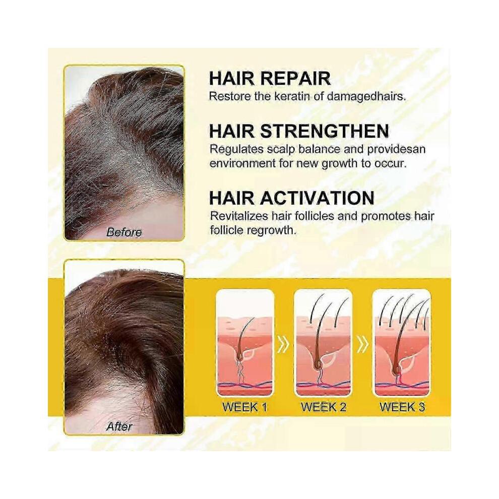 (2pcs)Rice Water Hair Serum,Rice Water for Hair Growth,Rice Water for Hair Growth,Moisturizing,Nourishing,Smooth Hair,Scalp Treatment,Split End Care