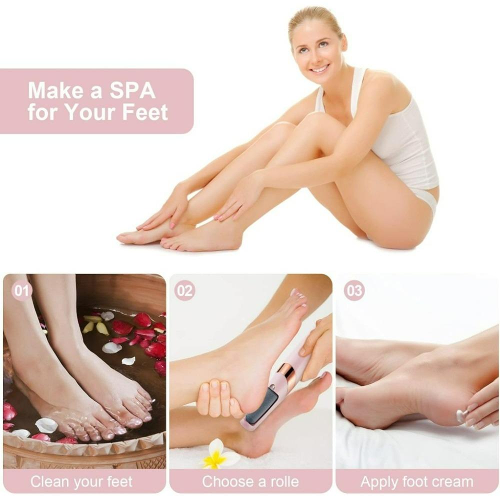 Electric Foot Callus Remover – USB Rechargeable Pedicure Tool with 2-Speed Roller and LED Light for Cracked Heels & Dead Skin