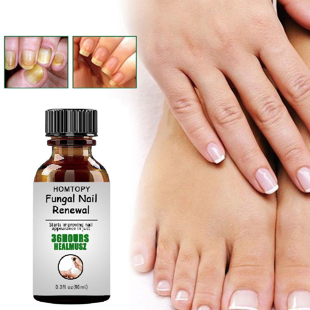 10ML Toenail Nail Fungus Treatment Repair Fingernail Device Foot Toenail Fungus Essential Care F0N3