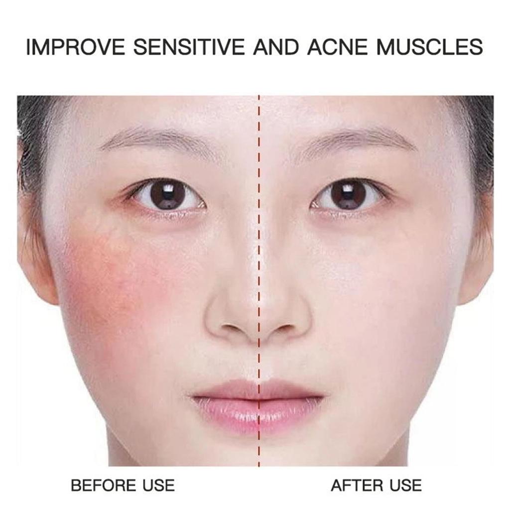 Dark Spot For Face, Dark Spot Corrector Cream, Ingredient, Enriching Skin Care For All Skin Tones, Melasma, Freckle, Sun Spot Improving