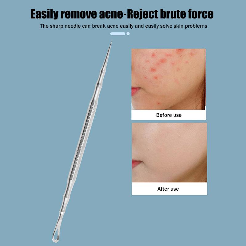 New Acne Blackhead Removal Needles Pimples Blackhead Clip Tweezers Beauty Artifact Blemish Extractor Remover Needle Tool