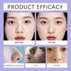 Nasal Pore Patch, Pore Cleaning Nasal Patch, Exfoliation And Blackhead Removal Care Nasal Patch