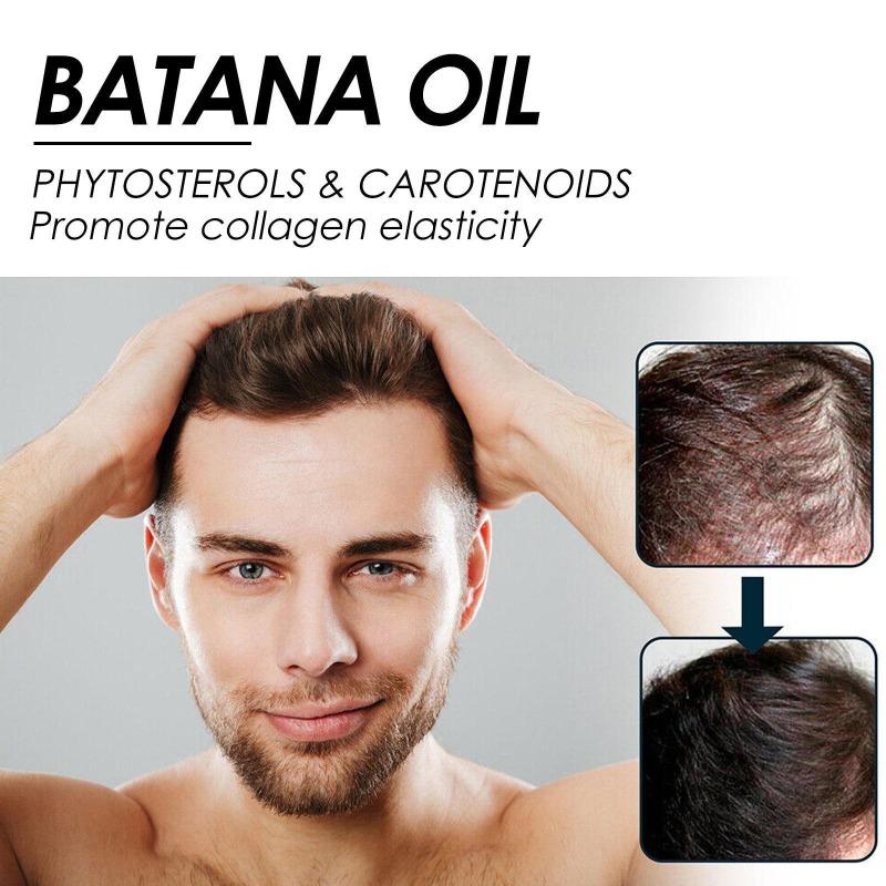 30 ml dichtes Haarspray spendet der Kopfhaut tiefenwirksam Feuchtigkeit, repariert das Haar, festigt das Haar und ist kompaktes Haarspray
