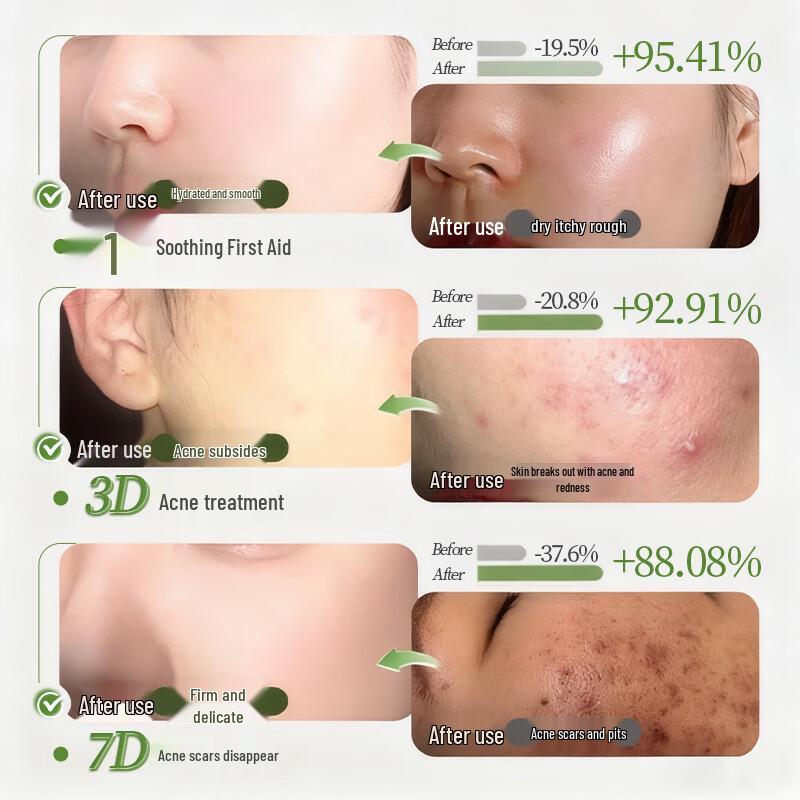 DR.CFUN Salicylic Acid Acne & Oil Control Sheet Mask