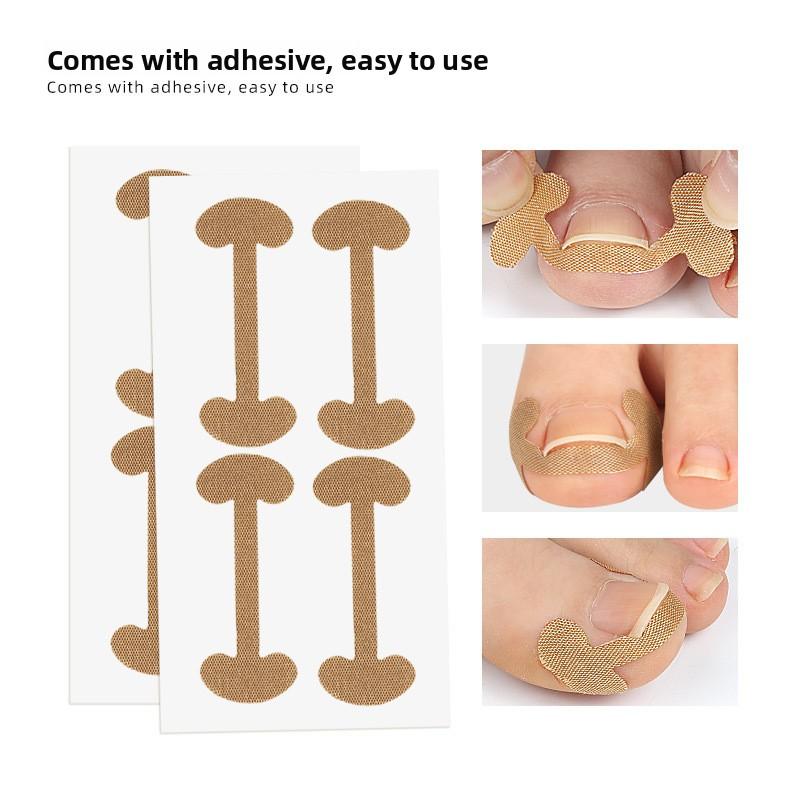 Manicure Artystyczny Bawełna Rowek Paznokcia Stopy Wkładka do Stopy Kciuk Rolka Plaster na Paznokieć Szybki Pedicure Deformacja Paznokcia u Stopy Mięsny Wyrost
