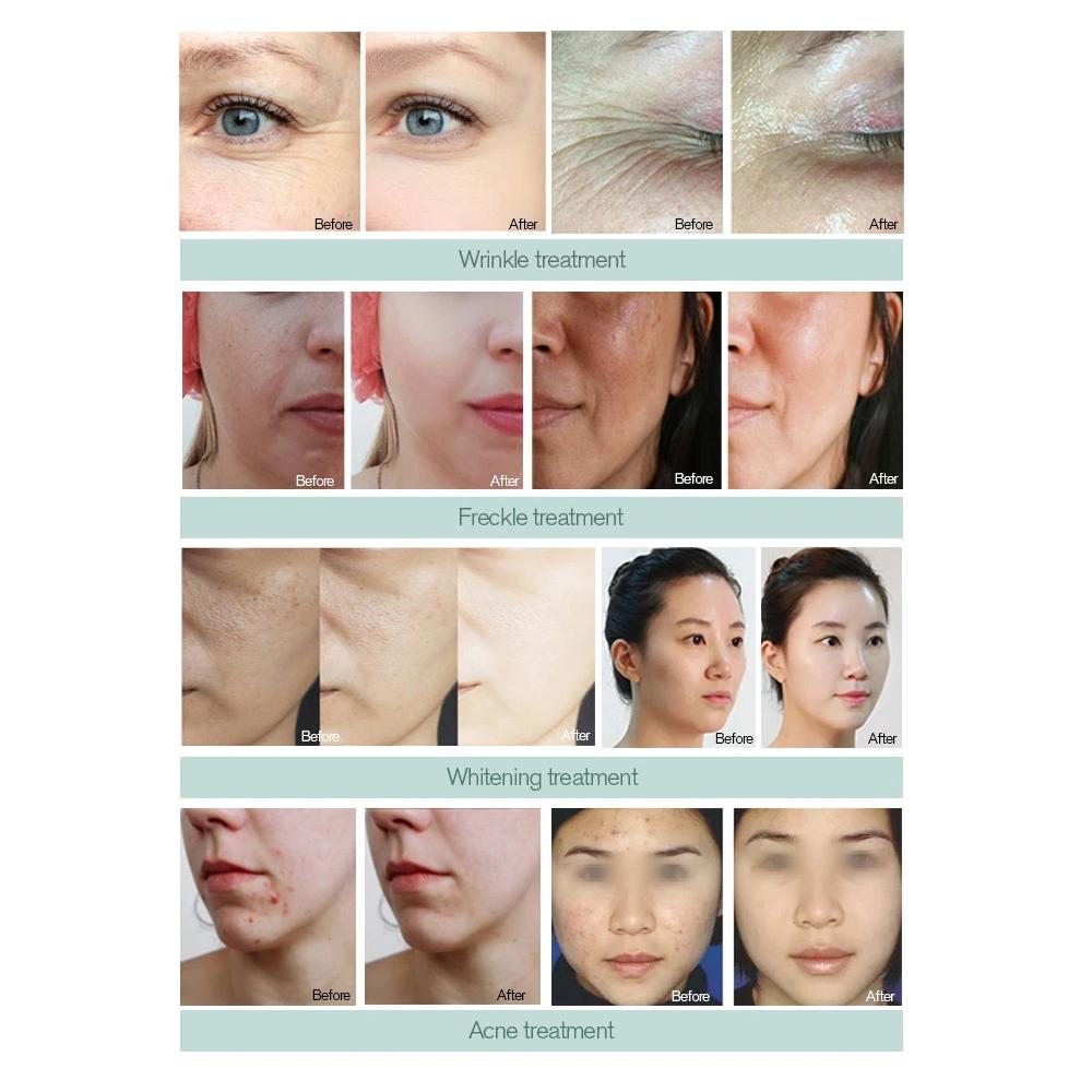 Professional DEP Water Mesotherapy Injector Skin Hydration Machine Injection Gun Skin Lifting Tighten Whitening Device