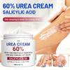 Krem z 60% mocznikiem, Krem do stóp i rąk z mocznikiem, Szybko wchłaniający się, Nietłusty, Bezpieczny dla skóry wrażliwej, Krem nawilżający do skóry ekstremalnie suchej, Prezent świąteczny-100G