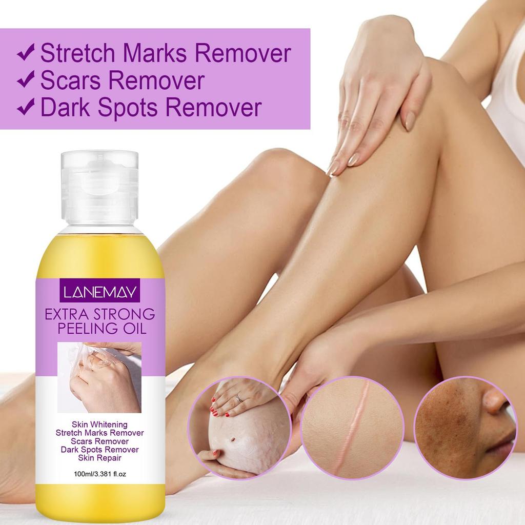 Extra Strong Peeling Oil-Skin Whitening & Repair-Remove Stretch Marks And Scars-Suitable for all Skin Types, 100ml