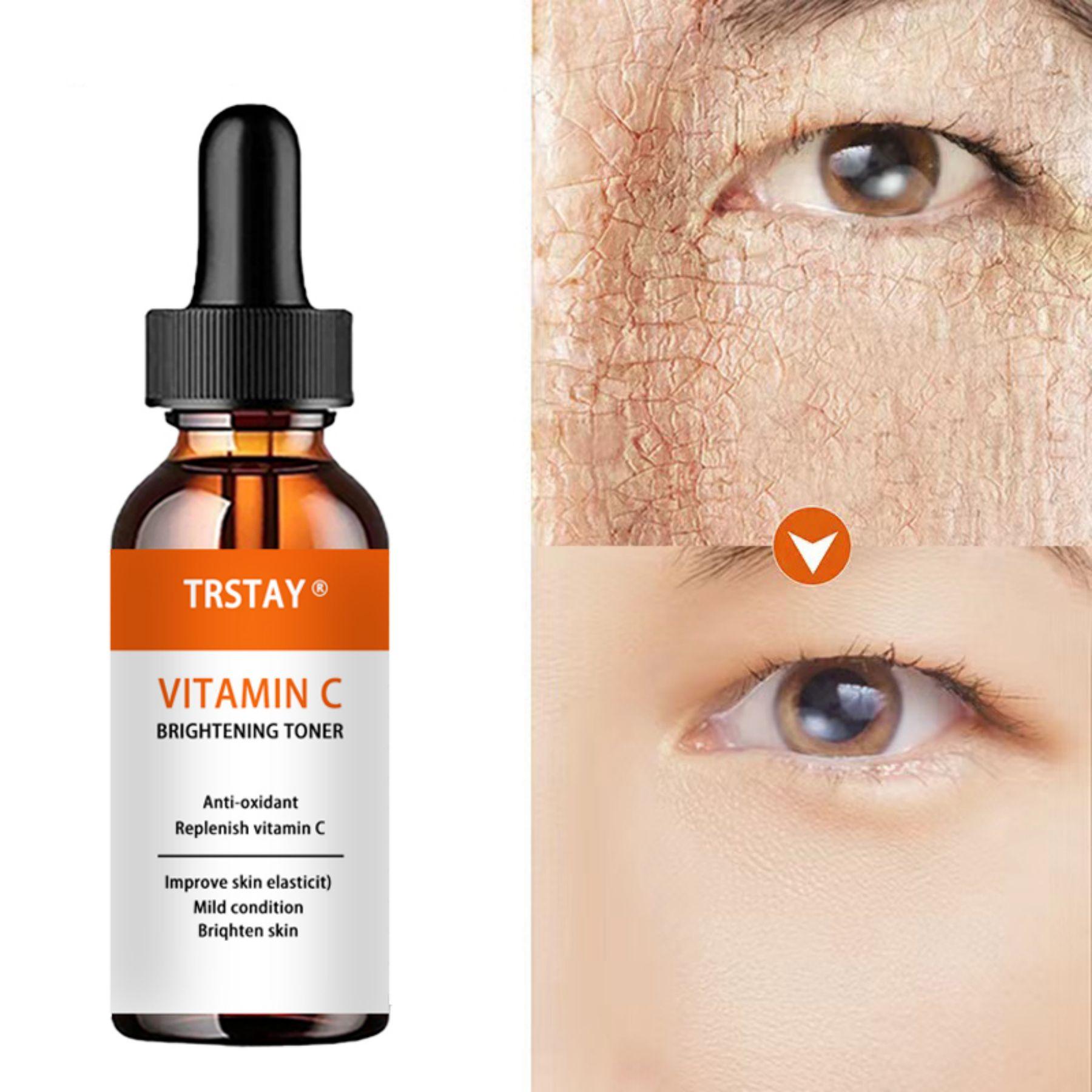 

Увлажняющий и восстанавливающий крем для лица, содержащий ретинол и гиалуроновую кислоту, способствует обновлению кожи и уменьшению морщин и тонких линий.