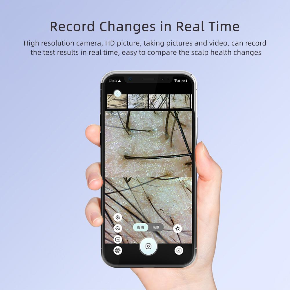 New 50X-200X Hair Follicles Scalp Detector Skin Analyzer Microscope Tool High Definition Skin Tester Support APP Wireless Use