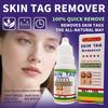 Active Repair Skin Tag Remover Serum Fast-Acting Safe Gentle Formula Home Use 30ml