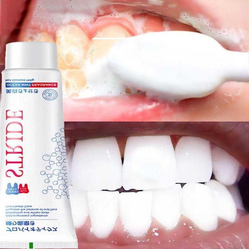 Dental Calculus Remover Whitening Removal Bad Breath Teeth Toothpaste Brightening Preventing Periodontitis Dental Cleansing Care