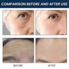 Anti-Wrinkle Serum, Reduce Lines Massage Tighten And Prevent Aging Facial Serum