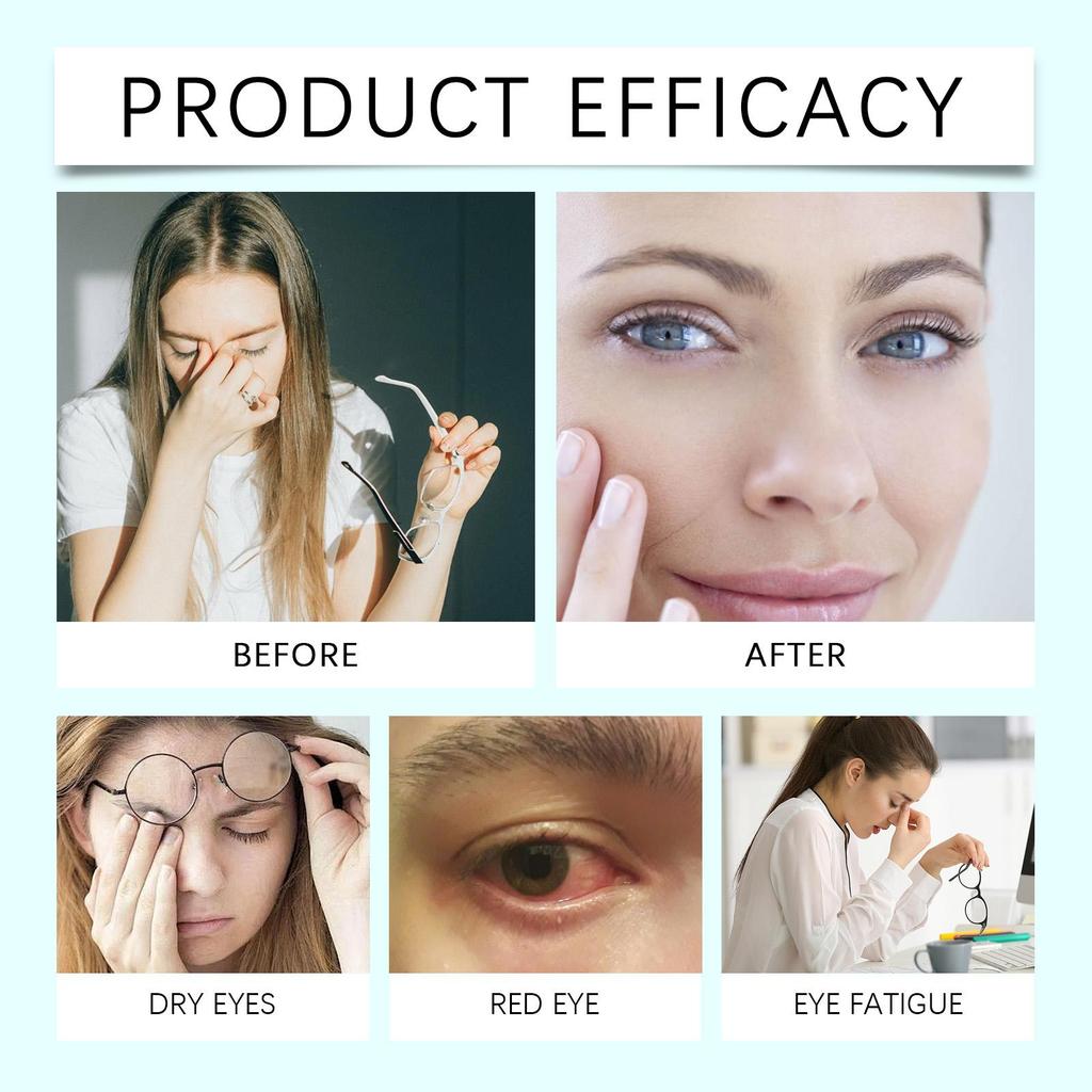 Soothing Eye Drops Relieve Eye Discomfort Gentle Moisturizing Improve Dryness Daily Eye Care