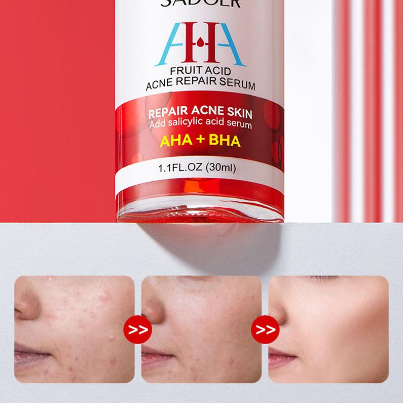 Acne Serum SADOER Fruit Acid Dilutes Acne Marks, Hydrates and Moisturizes