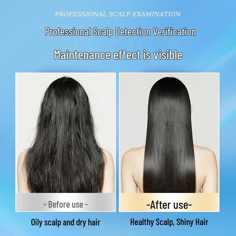 Zhuolanya Scalp Soothing Balancing Lotion