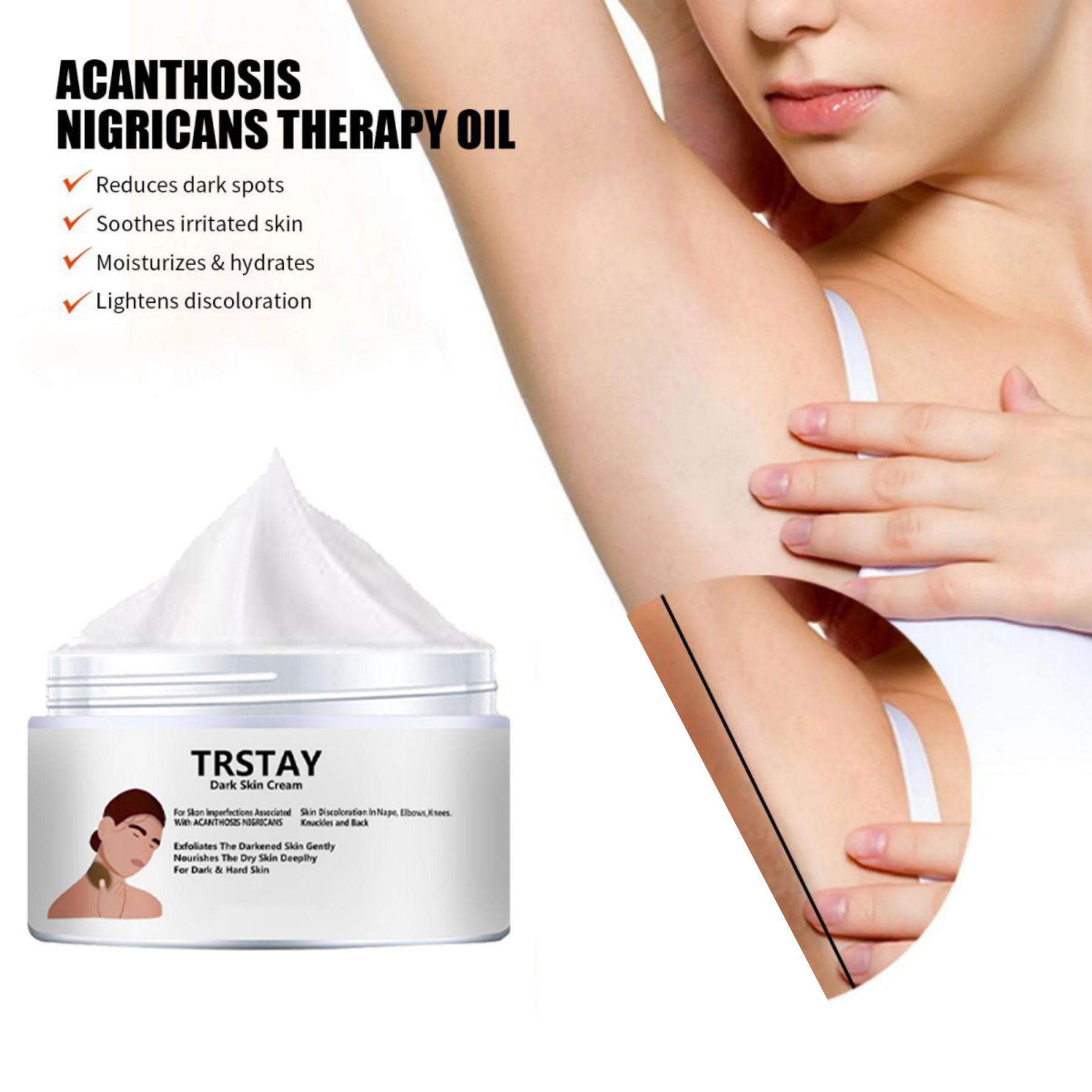 

5G/15G/30G/50G/ TRSTAY Крем для шеи Повышение упругости и увлажнения Тонкие линии шеи, глубокая защита кожи. Легкий и не грубый по текстуре.