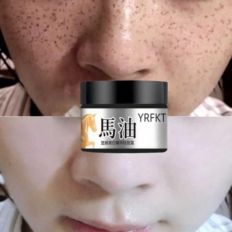 The Latest Horse Oil Freckle Cream, Fade, Stain, Sunburn, Chloasma, Freckles, Facial Care