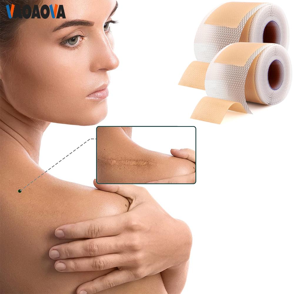 2 Rollen Silikon Narbenpflaster Keloid Beulenentfernungsstreifen Für Chirurgische Narben Verbrennungen Kaiserschnitt Dehnungsstreifen Patch Away Wundverbände
