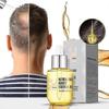 Ginger Essence Hair Growth Oil: 35ml Fast Regrowth Formula for Scalp Treatment and Healthier Hair