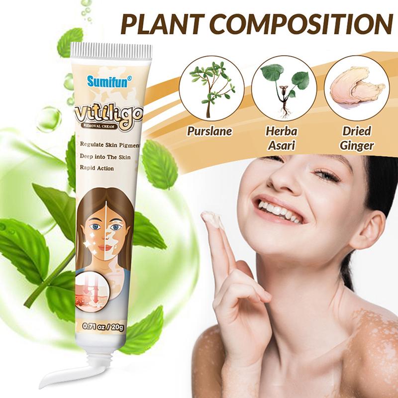 Behandlung Feuchtigkeitscreme Weißfleckenkrankheit Vitiligo Balsam Reparatursalbe