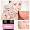 Remove acne mild repair acne pits acne marks nourishing moisturizing hydrating acne cream