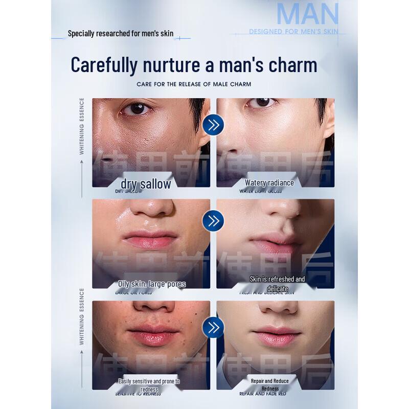 Korean Five Grains Oil Control Lotion