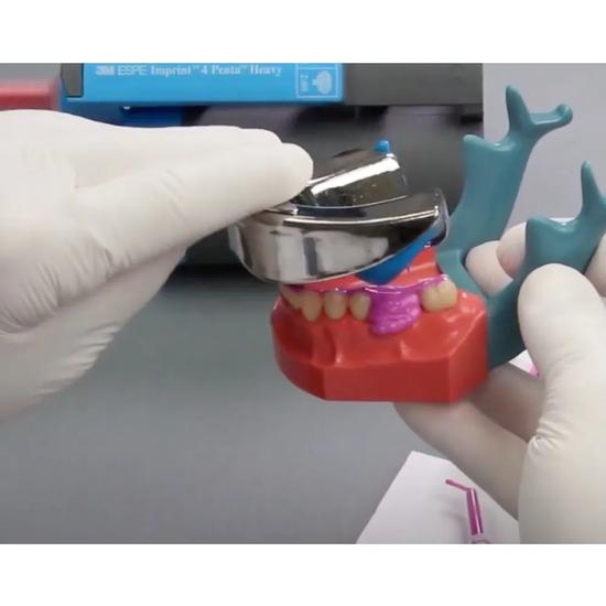GDC Dentulous Non-Perforated Impression Trays Lower # 3 (ITRLDNPL3)