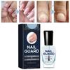 Ingrown Nail Repair Solution Safe Painless Anti-Fungal Toe Care Serum for Men & Women Nail Fungus Treatment 15ml