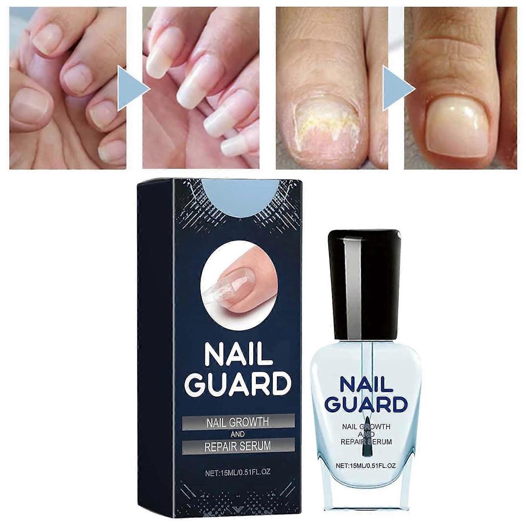 Ingrown Nail Repair Solution Safe Painless Anti-Fungal Toe Care Serum for Men & Women Nail Fungus Treatment 15ml