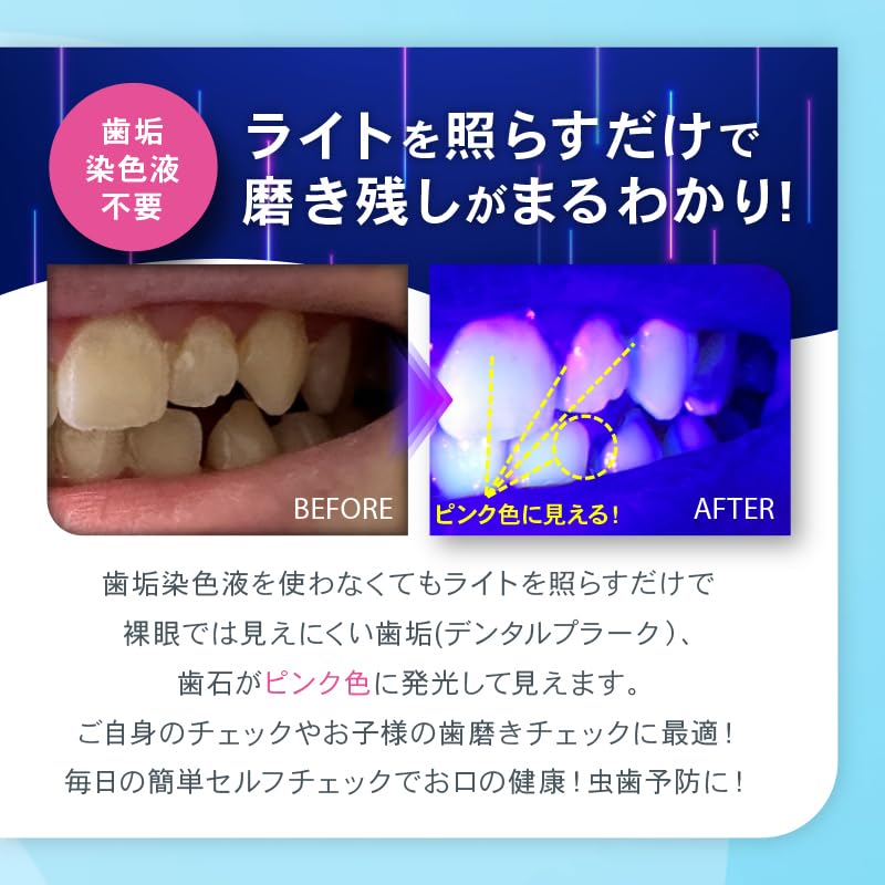 [Identify hidden plaque at a glance] OMNI Dental Plaque Check Light (Black)