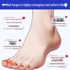 Baibang Qiling Nail Fungus Treatment