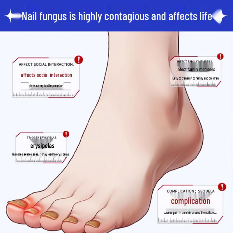 Baibang Qiling Nail Fungus Treatment